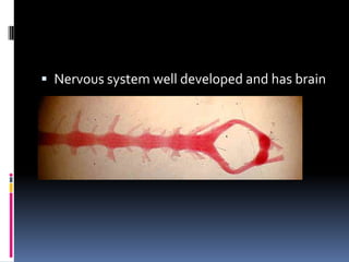 Nervous system well developed and has brain
 