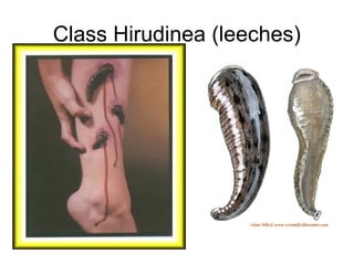 Class Hirudinea (leeches)
 