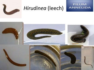 Hirudinea (leech)
 