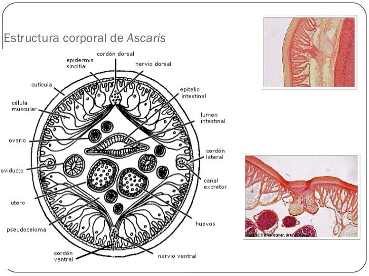 Resultado de imagen para phylum nematodos ascaris