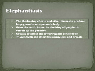    The thickening of skin and other tissues to produce
    huge growths on a person’s body
   Growths result from the blocking of lymphatic
    vessels by the parasite
   Usually found in the lower regions of the body
   W. Bancrofti can affect the arms, legs, and breasts
 