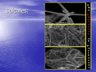 Spicules:
 