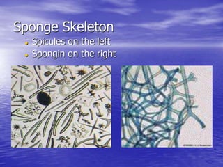 Sponge Skeleton
 Spicules on the left
 Spongin on the right
 