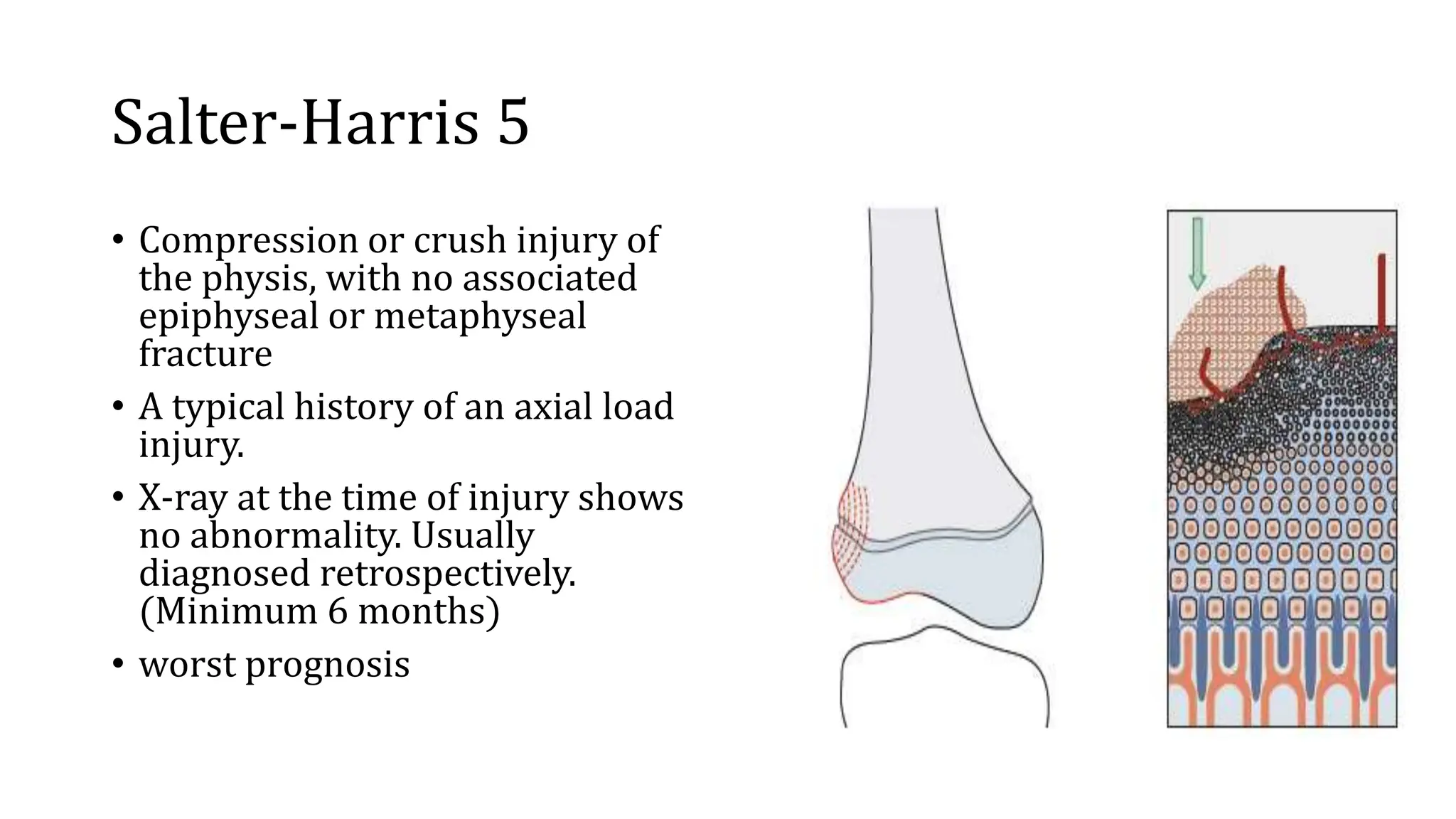 physeal injuries.pptx