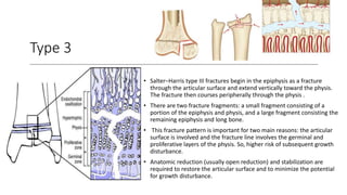Type 3
• Salter–Harris type III fractures begin in the epiphysis as a fracture
through the articular surface and extend vertically toward the physis.
The fracture then courses peripherally through the physis .
• There are two fracture fragments: a small fragment consisting of a
portion of the epiphysis and physis, and a large fragment consisting the
remaining epiphysis and long bone.
• This fracture pattern is important for two main reasons: the articular
surface is involved and the fracture line involves the germinal and
proliferative layers of the physis. So, higher risk of subsequent growth
disturbance.
• Anatomic reduction (usually open reduction) and stabilization are
required to restore the articular surface and to minimize the potential
for growth disturbance.
 