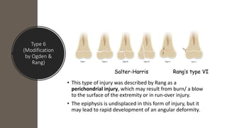 Type 6
(Modification
by Ogden &
Rang)
• This type of injury was described by Rang as a
perichondrial injury, which may result from burn/ a blow
to the surface of the extremity or in run-over injury.
• The epiphysis is undisplaced in this form of injury, but it
may lead to rapid development of an angular deformity.
 