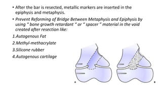• After the bar is resected, metallic markers are inserted in the
epiphysis and metaphysis.
• Prevent Reforming of Bridge Between Metaphysis and Epiphysis by
using “ bone growth retardant “ or “ spacer ” material in the void
created after resection like:
1.Autogenous Fat
2.Methyl-methacrylate
3.Silicone rubber
4.Autogenous cartilage
 