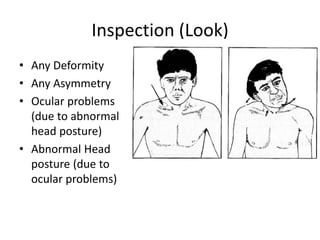 Inspection (Look)
• Any Deformity
• Any Asymmetry
• Ocular problems
(due to abnormal
head posture)
• Abnormal Head
posture (due to
ocular problems)
 