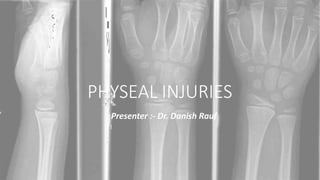 PHYSEAL INJURIES
Presenter :- Dr. Danish Rauf
l
 