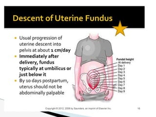 ? If fundus is deviated to the left or to the right or elevated
above level of umbilicus always rule out DISTENDED
BLADDER...