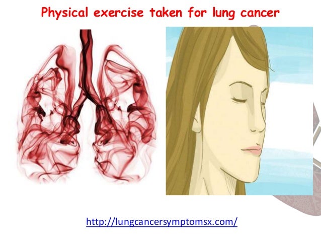 Physical exercise taken to cure lung cancer