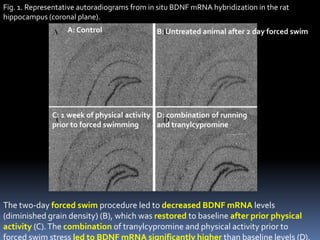 Fig. 1. Representative autoradiograms from in situ BDNF mRNA hybridization in the rat
hippocampus (coronal plane).
                   A: Control                B: Untreated animal after 2 day forced swim




              C: 1 week of physical activity D: combination of running
              prior to forced swimming       and tranylcypromine




The two-day forced swim procedure led to decreased BDNF mRNA levels
(diminished grain density) (B), which was restored to baseline after prior physical
activity (C). The combination of tranylcypromine and physical activity prior to
forced swim stress led to BDNF mRNA significantly higher than baseline levels (D).
 
