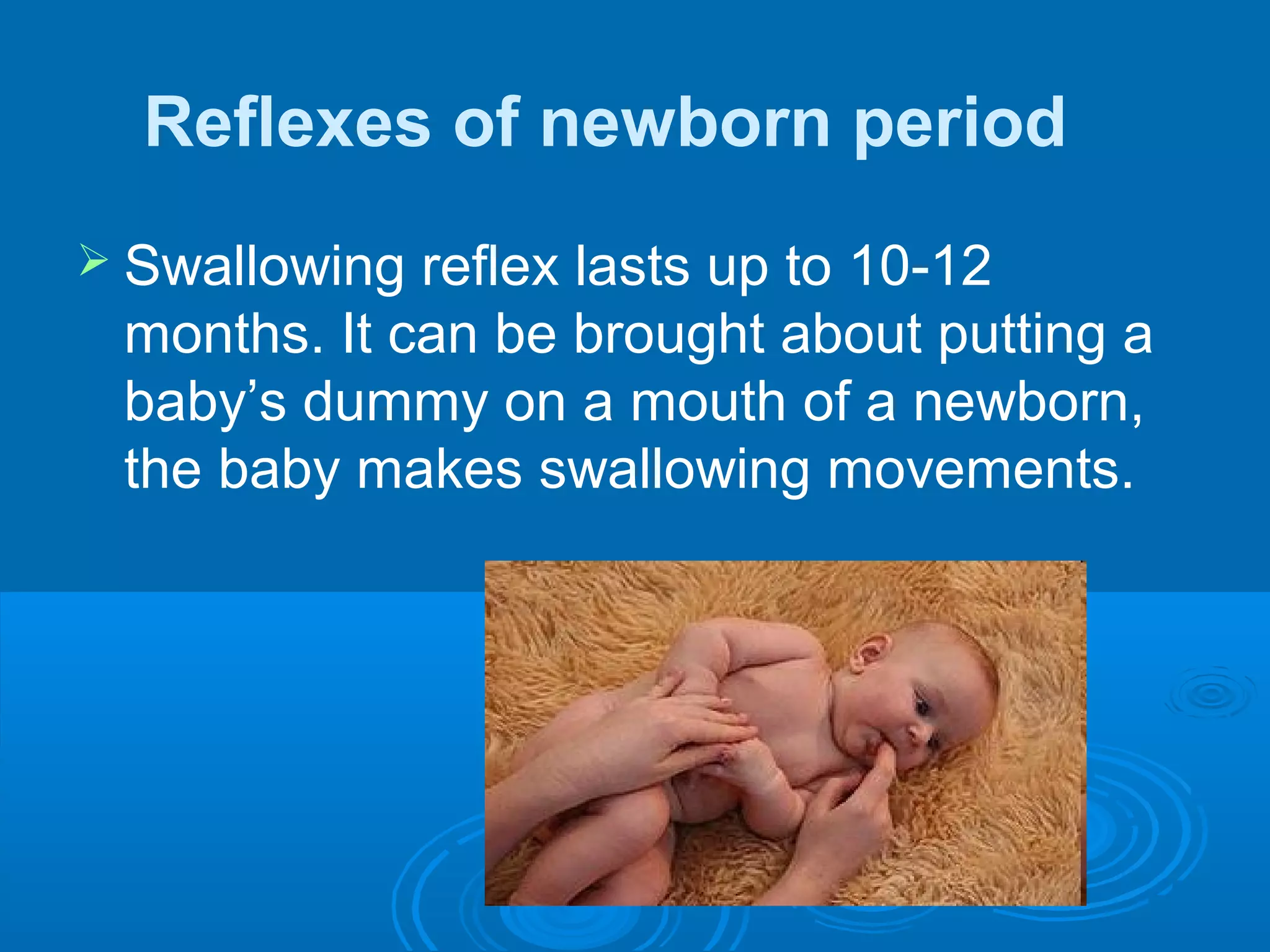 Reflexes of newborn period
 Swallowing reflex lasts up to 10-12
months. It can be brought about putting a
baby’s dummy on a mouth of a newborn,
the baby makes swallowing movements.
 