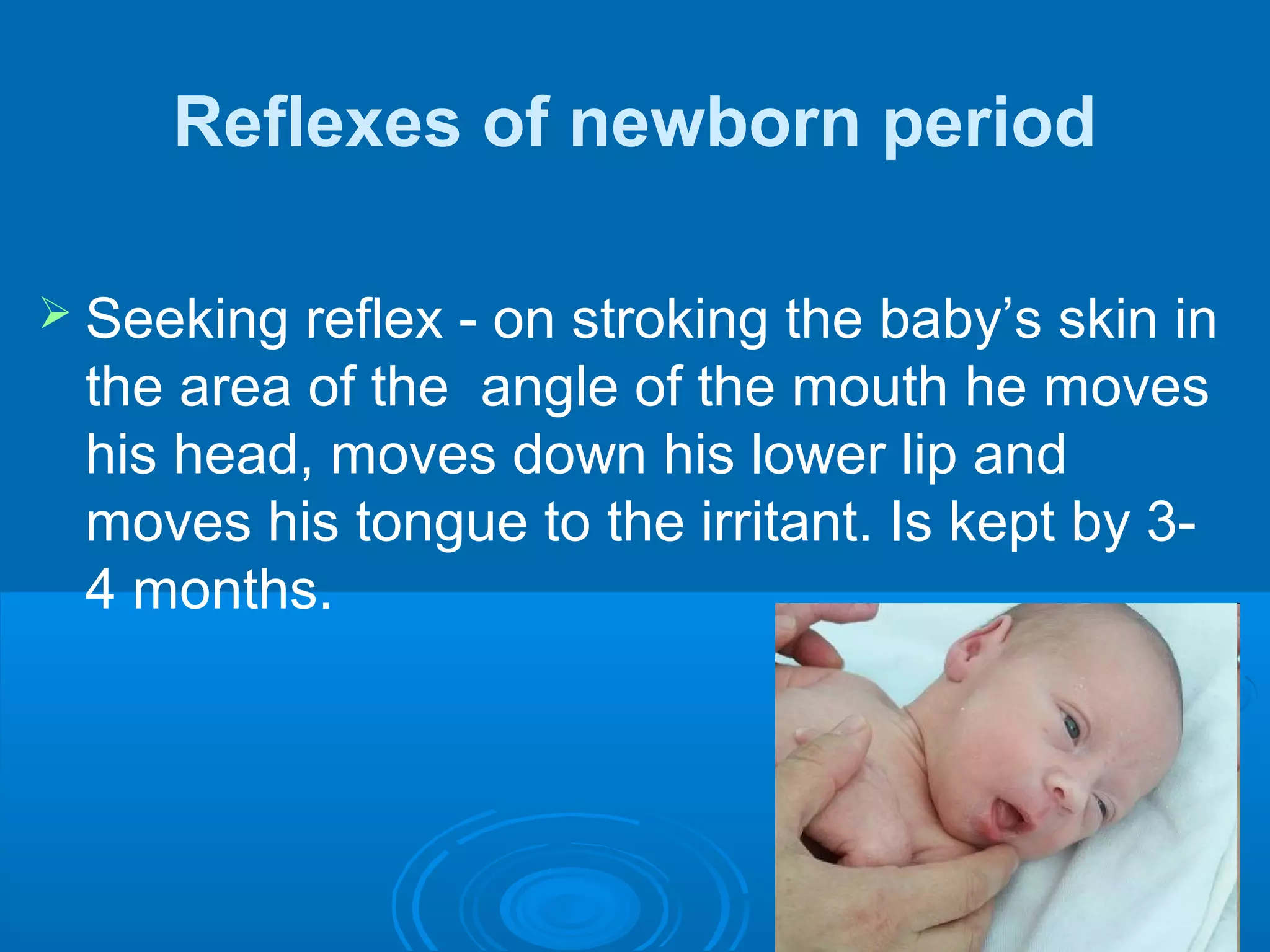 Reflexes of newborn period
 Seeking reflex - on stroking the baby’s skin in
the area of the angle of the mouth he moves
his head, moves down his lower lip and
moves his tongue to the irritant. Is kept by 3-
4 months.
 