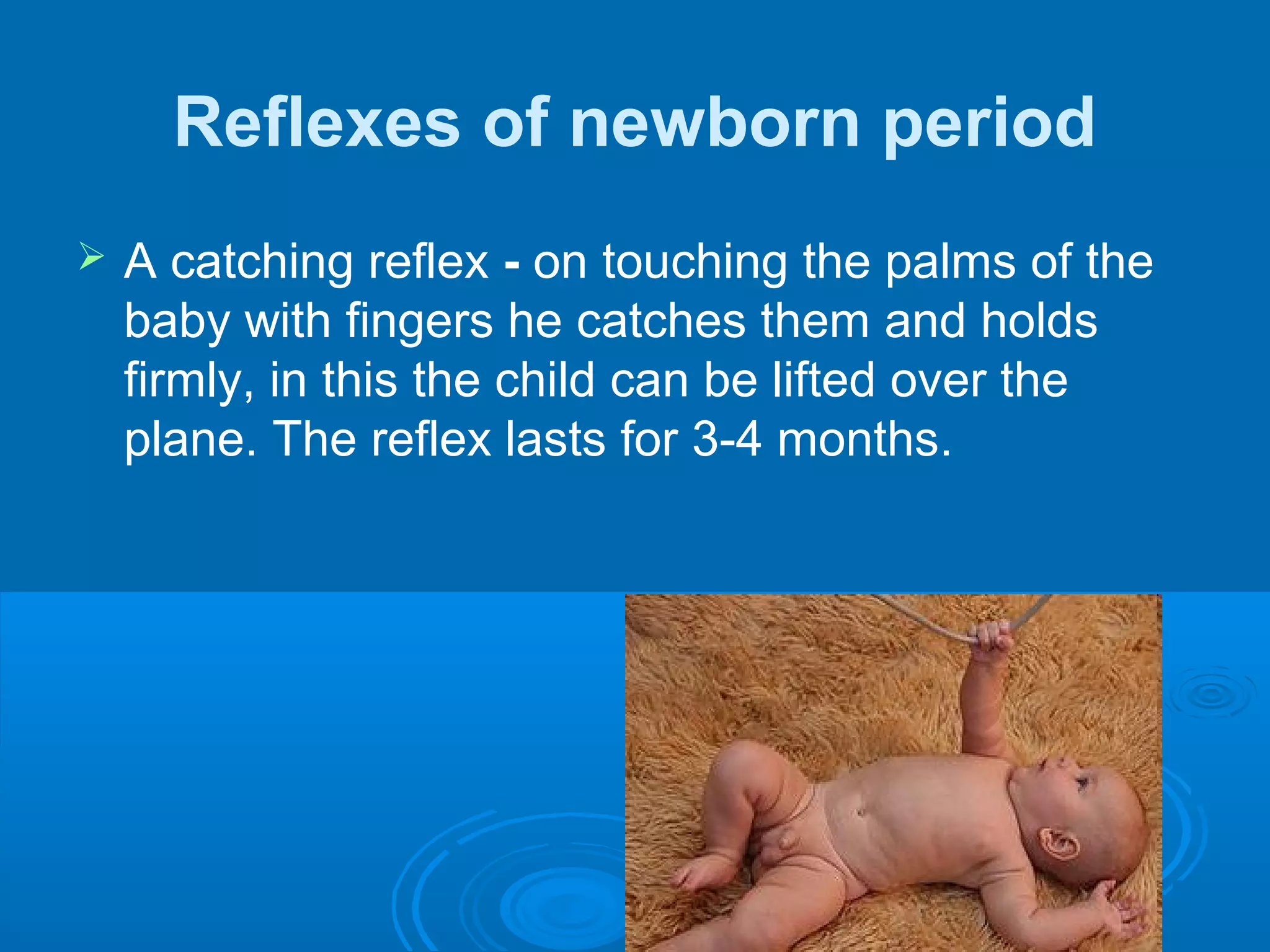 Reflexes of newborn period
 A catching reflex - on touching the palms of the
baby with fingers he catches them and holds
firmly, in this the child can be lifted over the
plane. The reflex lasts for 3-4 months.
 