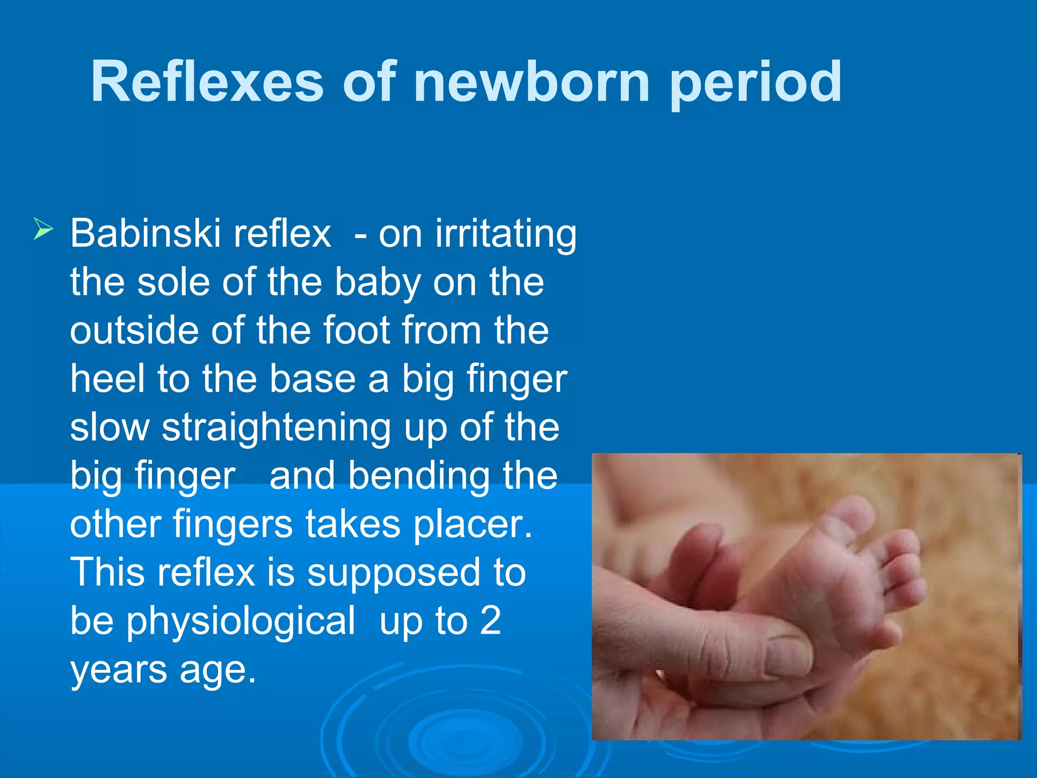 Reflexes of newborn period
 Babinski reflex - on irritating
the sole of the baby on the
outside of the foot from the
heel to the base a big finger
slow straightening up of the
big finger and bending the
other fingers takes placer.
This reflex is supposed to
be physiological up to 2
years age.
 