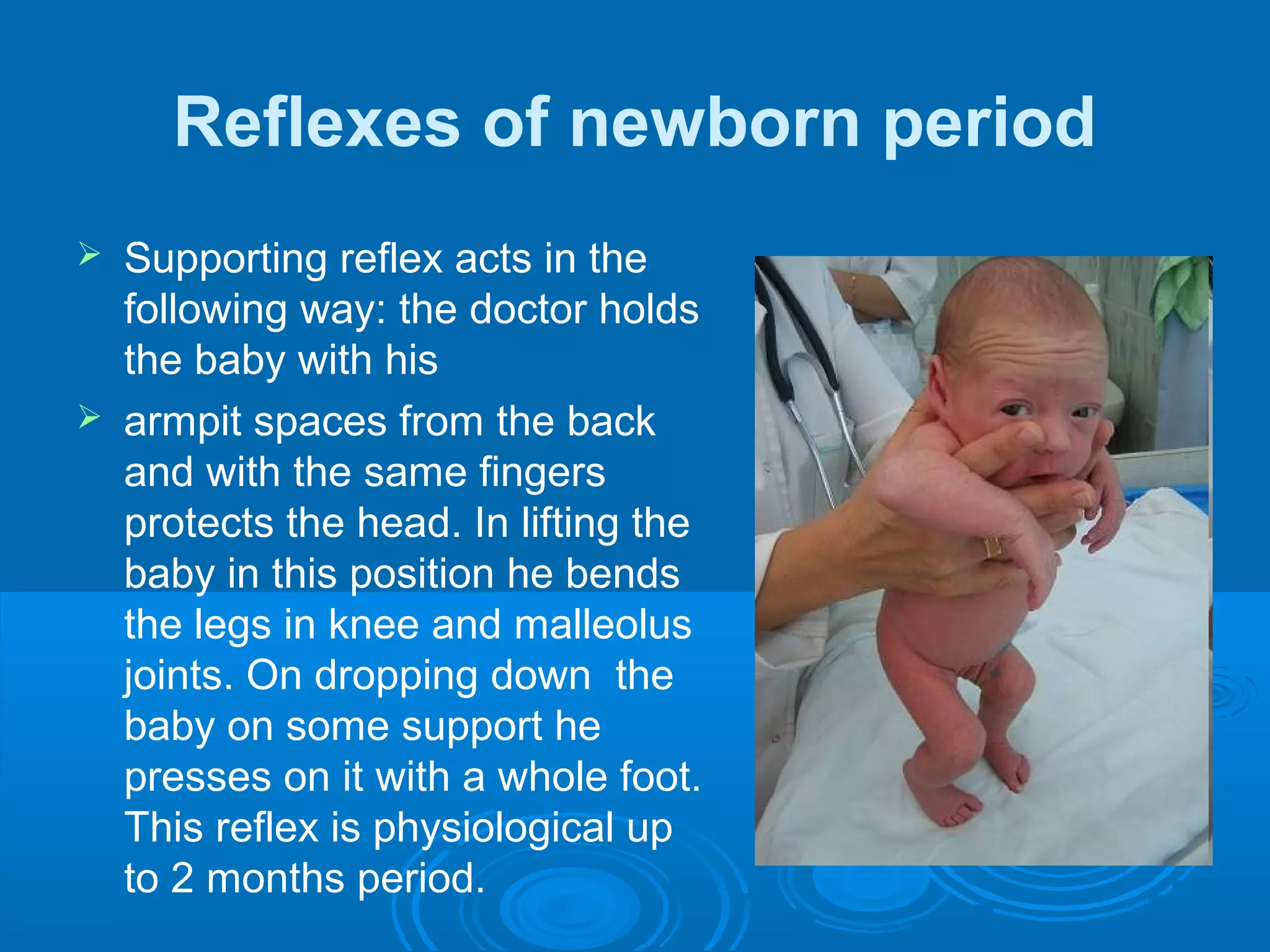 Reflexes of newborn period
 Supporting reflex acts in the
following way: the doctor holds
the baby with his
 armpit spaces from the back
and with the same fingers
protects the head. In lifting the
baby in this position he bends
the legs in knee and malleolus
joints. On dropping down the
baby on some support he
presses on it with a whole foot.
This reflex is physiological up
to 2 months period.
 