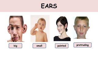 EARS
big small pointed protruding
 