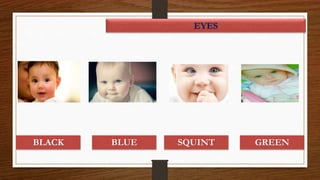 EYES
BLACK BLUE GREENSQUINT
 