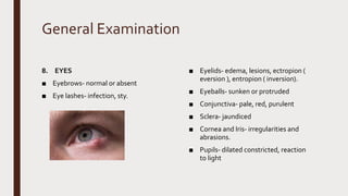 General Examination
8. EYES
■ Eyebrows- normal or absent
■ Eye lashes- infection, sty.
■ Eyelids- edema, lesions, ectropion (
eversion ), entropion ( inversion).
■ Eyeballs- sunken or protruded
■ Conjunctiva- pale, red, purulent
■ Sclera- jaundiced
■ Cornea and Iris- irregularities and
abrasions.
■ Pupils- dilated constricted, reaction
to light
 
