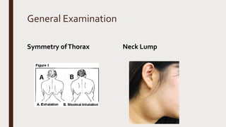 General Examination
Symmetry ofThorax Neck Lump
 