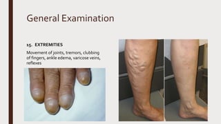 General Examination
15. EXTREMITIES
Movement of joints, tremors, clubbing
of fingers, ankle edema, varicose veins,
reflexes
 