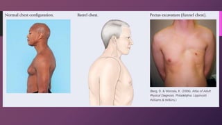 Physical Assessment 13 - Thorax Lungs Heart Sounds.ppt