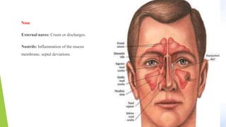 Nose
External nares: Crusts or discharges.
Nostrils: Inflammation of the mucus
membrane, septal deviations.
 