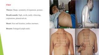 Chest
Thorax: Shape, symmetry of expansion, posture.
Breath sounds: Sigh, swish, rustle, wheezing,
crepitations, pleural rub etc.
Heart: Size and location, cardiac murmurs.
Breasts: Enlarged lymph nodes.
 