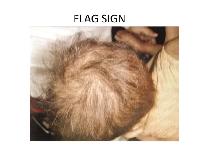 Physical Assessment Children And Neonates Pptx