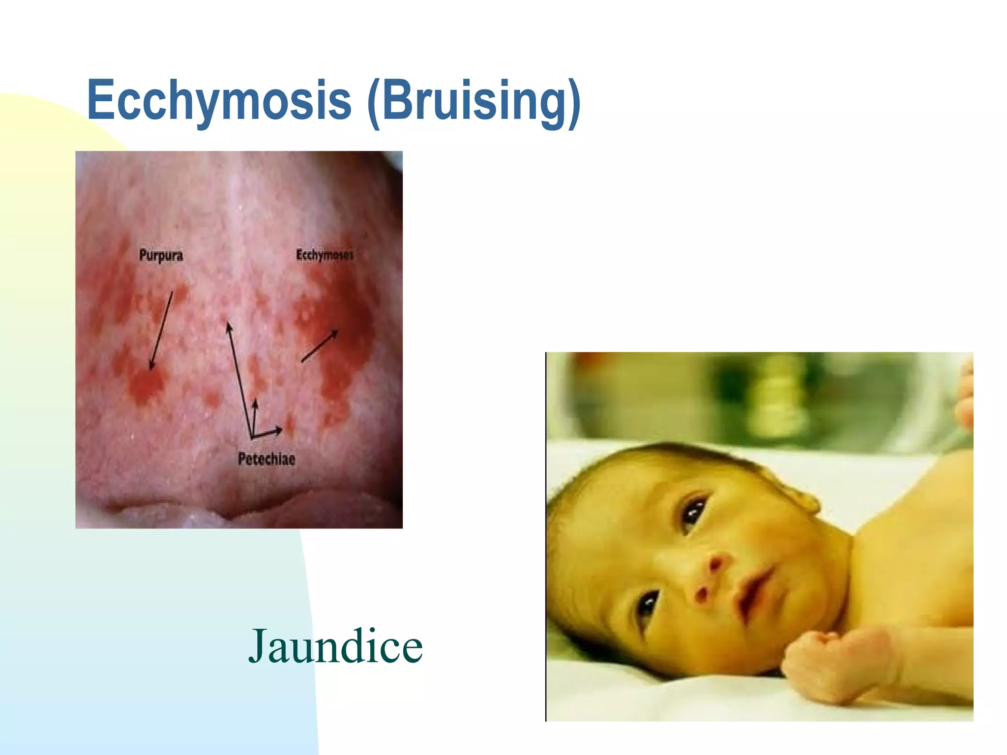 Physical assessment of the neonate | PPT