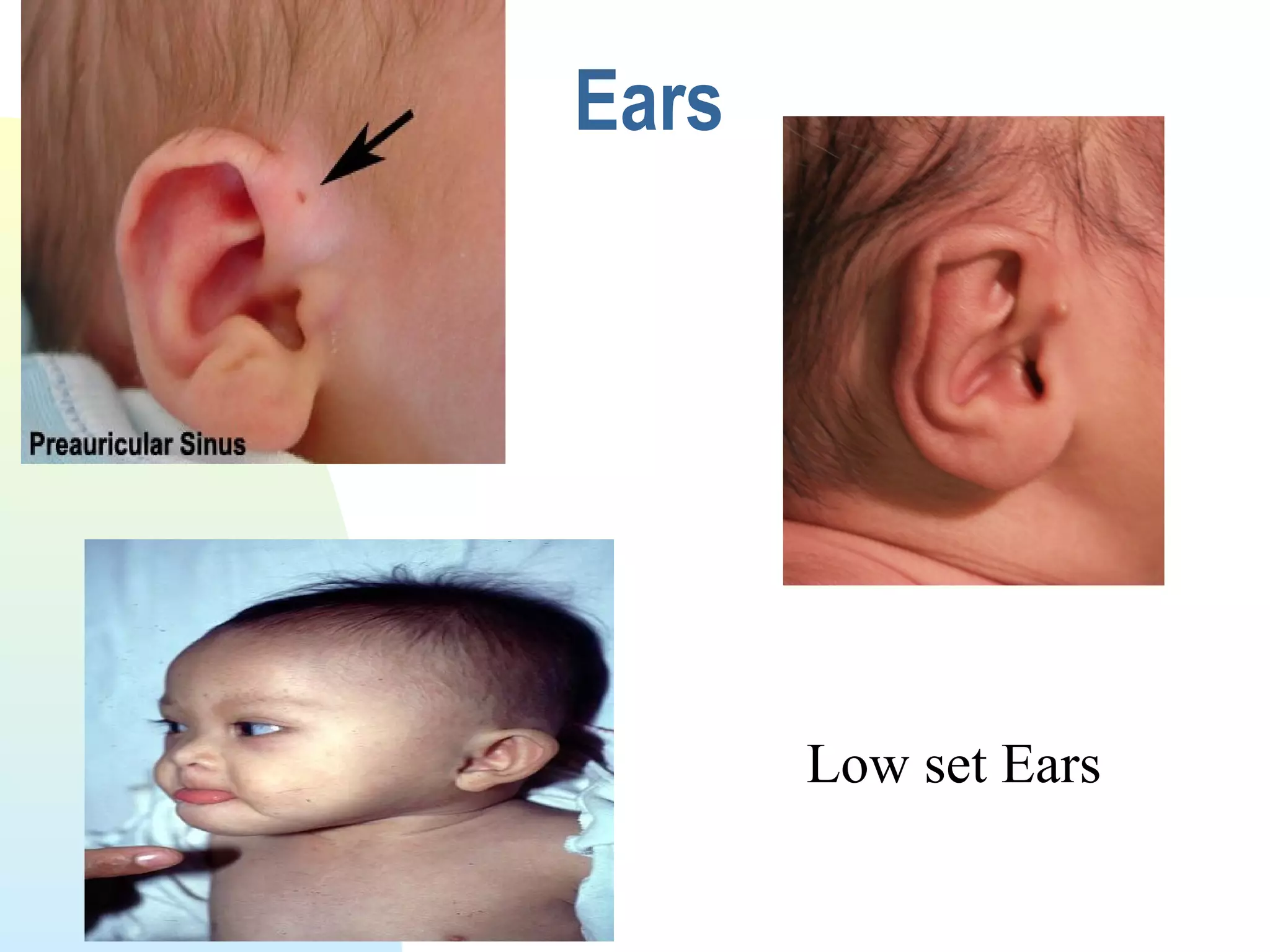 Physical assessment of the neonate | PPT