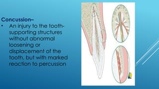 Physical & Chemical Injuries of the oral cavity.pptx