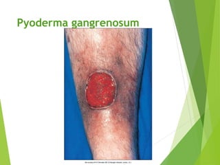 physical exam for skin such as petechia purpura erythema | PPTX