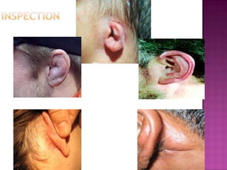 CausesvertigoDefinitionTrue vertigo or dizzinessPeripheral or central Main common causesMedical or rehabilitation therapy