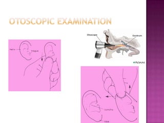 Clinical examinationInspectionPalpation Otoscopic examinationMicroscopic examinationHearing assessmentOther ENT parts assessmentCranial nerves assessment