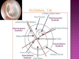 Otoscopic examination
