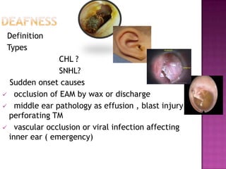 Deafness Definition TypesCHL ?SNHL?Sudden onset causes occlusion of EAM by wax or discharge