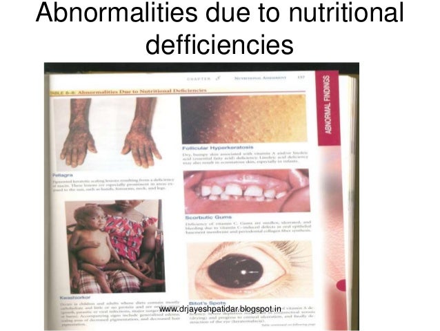 physical exam normal findings