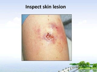 Inspect skin lesion
 