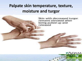Palpate skin temperature, texture,
moisture and turgor
 