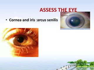 ASSESS THE EYE
• Cornea and iris :arcus senilis
 