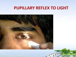 PUPILLARY REFLEX TO LIGHT
 