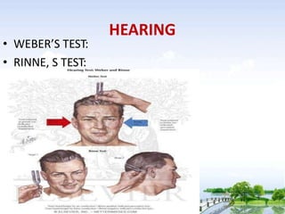 HEARING
• WEBER’S TEST:
• RINNE, S TEST:
 