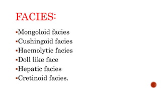 FACIES:
Mongoloid facies
Cushingoid facies
Haemolytic facies
Doll like face
Hepatic facies
Cretinoid facies.
 
