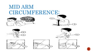 MID ARM
CIRCUMFERENCE:
 