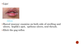 Lips:
chilosis
Buccal mucosa: examine on both side of swelling and
ulcers, koplik’s spot, apthous ulcers, oral thrush.
Elicit the gag reflex
 