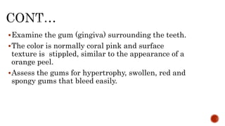 Examine the gum (gingiva) surrounding the teeth.
The color is normally coral pink and surface
texture is stippled, similar to the appearance of a
orange peel.
Assess the gums for hypertrophy, swollen, red and
spongy gums that bleed easily.
 