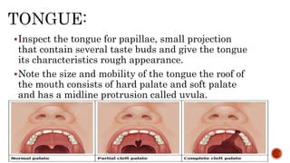 Inspect the tongue for papillae, small projection
that contain several taste buds and give the tongue
its characteristics rough appearance.
Note the size and mobility of the tongue the roof of
the mouth consists of hard palate and soft palate
and has a midline protrusion called uvula.
 