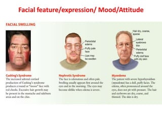 Facial feature/expression/ Mood/Attitude
 